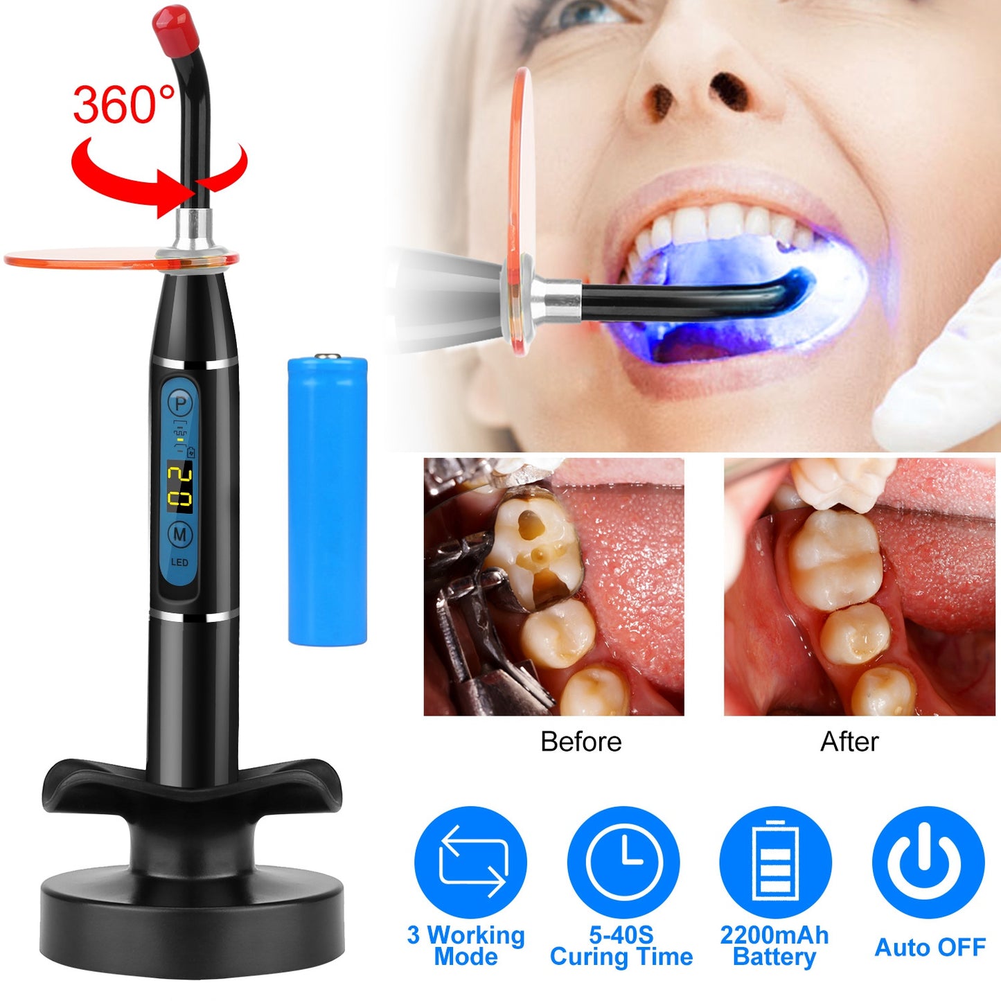 5W Cordless Dental LED Curing Light Lamp 1500mw/cm2