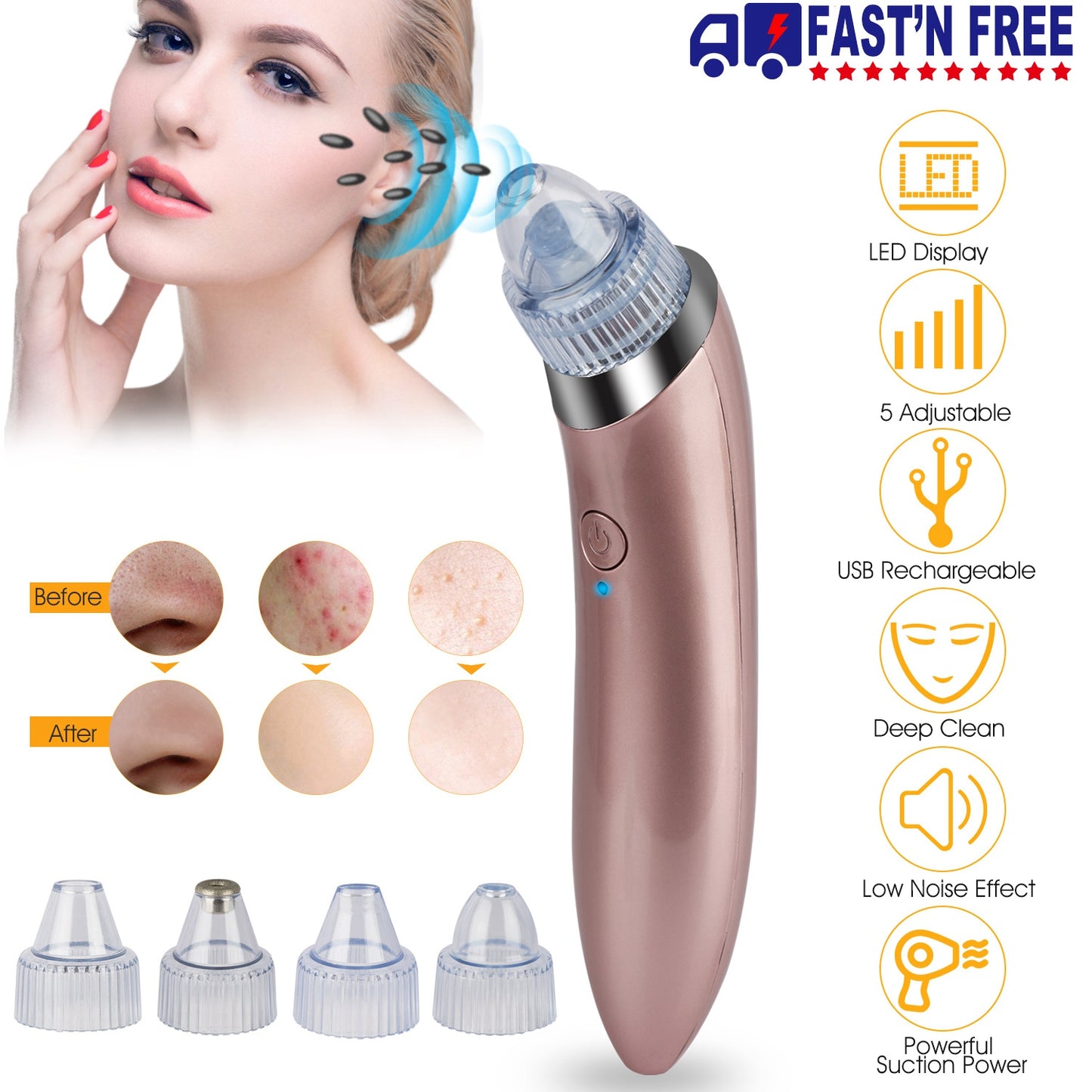Electric Blackhead Remover Vacuum Suction Facial Pore Cleaner Acne Pimple Extractor Skin Care Cleaning Tool with 4 Suction Head