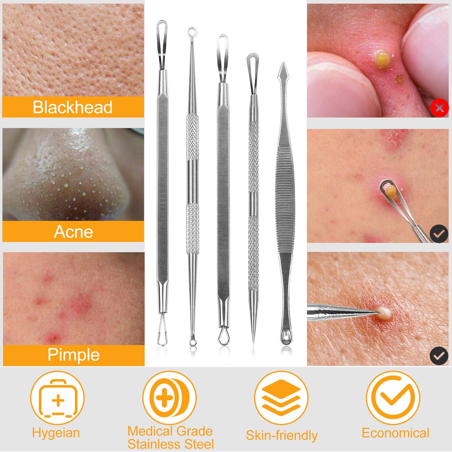 5 Pcs Blackhead Remover Kit Pimple Comedone Extractor Tool Set Stainless Steel Facial Acne Blemish Whitehead Popping Zit Removing for Nose Face Skin C