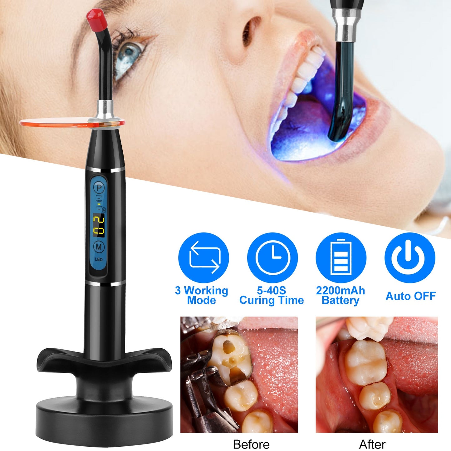 5W Cordless Dental LED Curing Light Lamp 1500mw/cm2