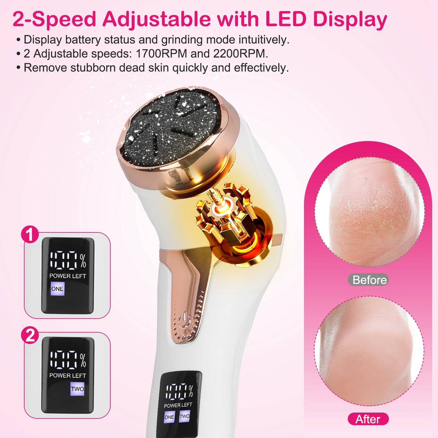 17Pcs Electric Foot Callus Remover with Vacuum Foot Grinder Rechargeable Foot File Dead Skin Pedicure Machine with 3 Grinding Heads 2 Speeds Foot Care